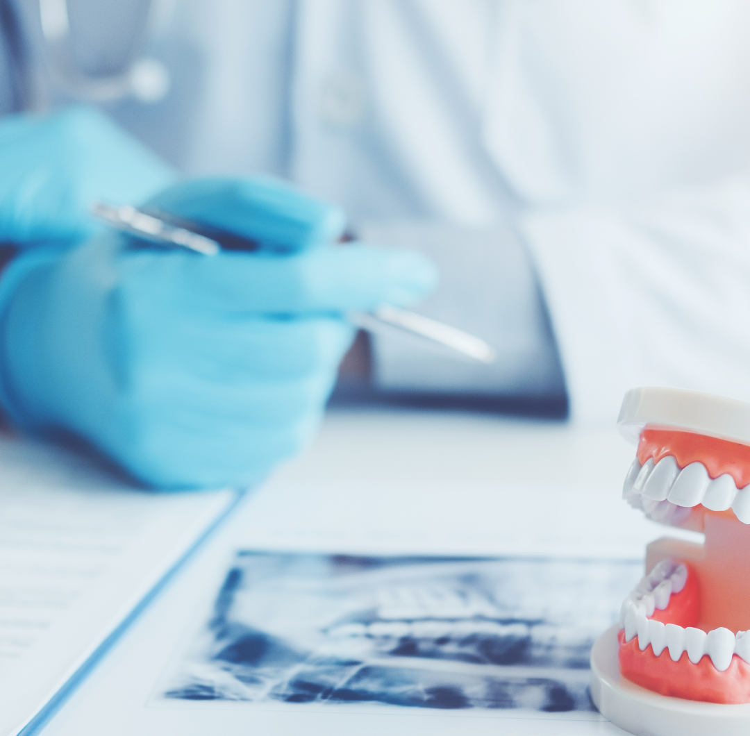 grupo-ohi-carillas-dentales