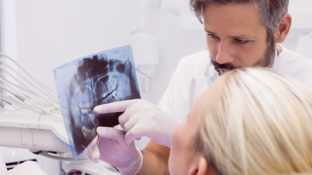 ¿Cuánto tardan en cicatrizar los implantes dentales?