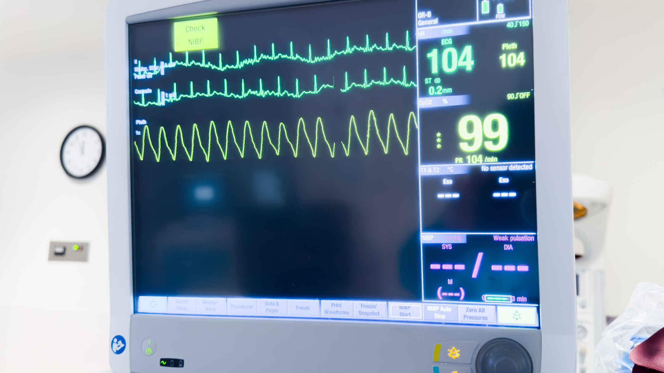 Sedacion consciente con monitor multiparámetro conectado midiendo las constantes vitales del paciente