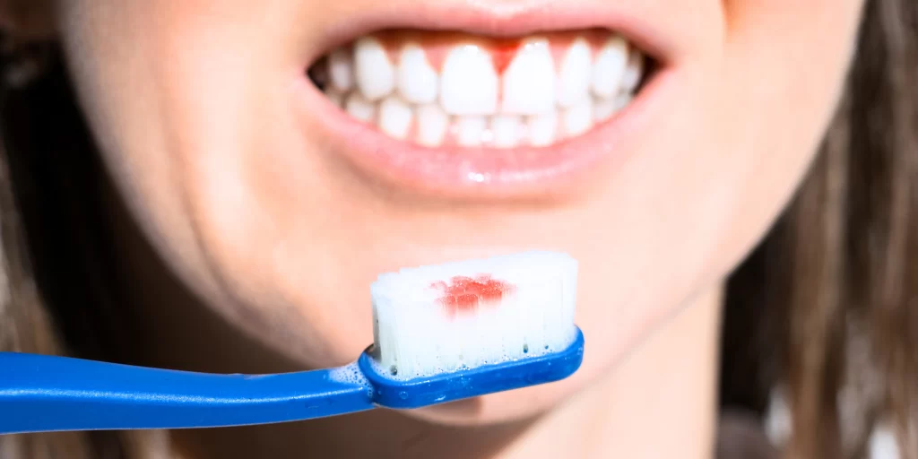 Mujer muestra el cepillo con sangre tras cepillarse los dientes