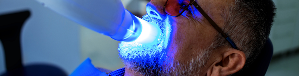 Tratamiento de blanqueamiento dental profesional en clínica dental hospitalaria OHI Madrid