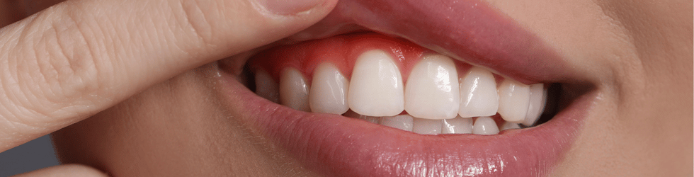 Dentista en Valladolid: 7 claves esenciales si tomas medicación