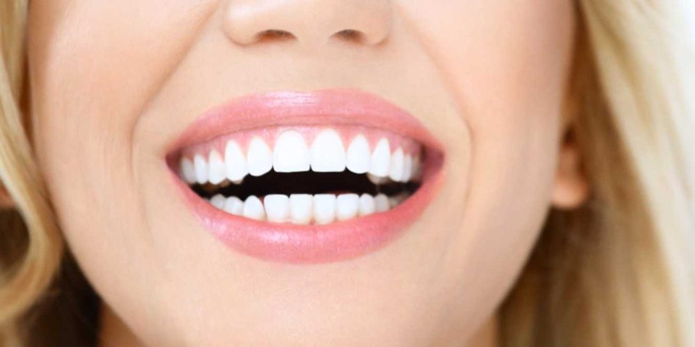 Diseño de sonrisa_Madrid